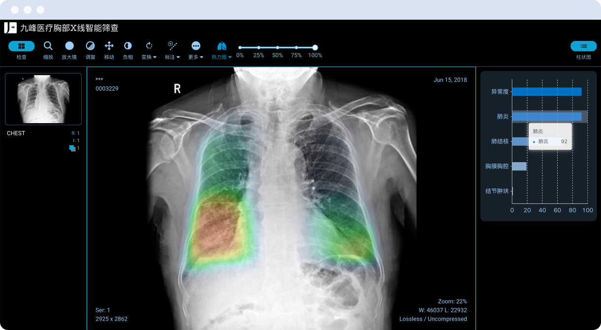 CT/MRI annotation platform